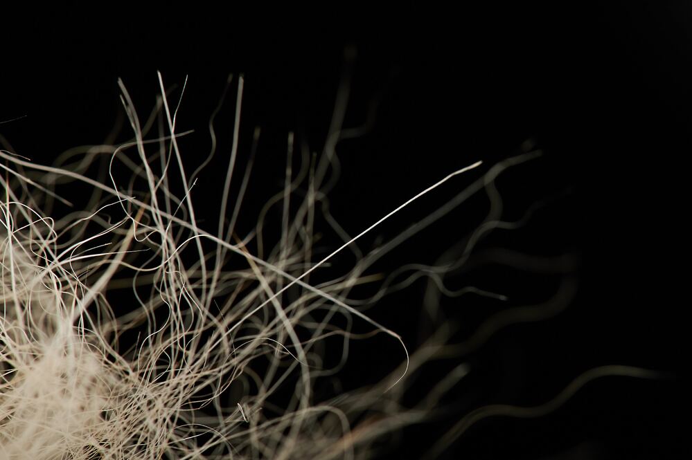 Animal hair fibres on a dark background — anthrax-relevant material